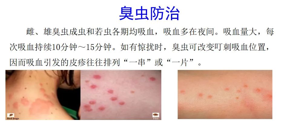 灭臭虫用什么药最好_灭臭虫的最好方法_灭臭虫***