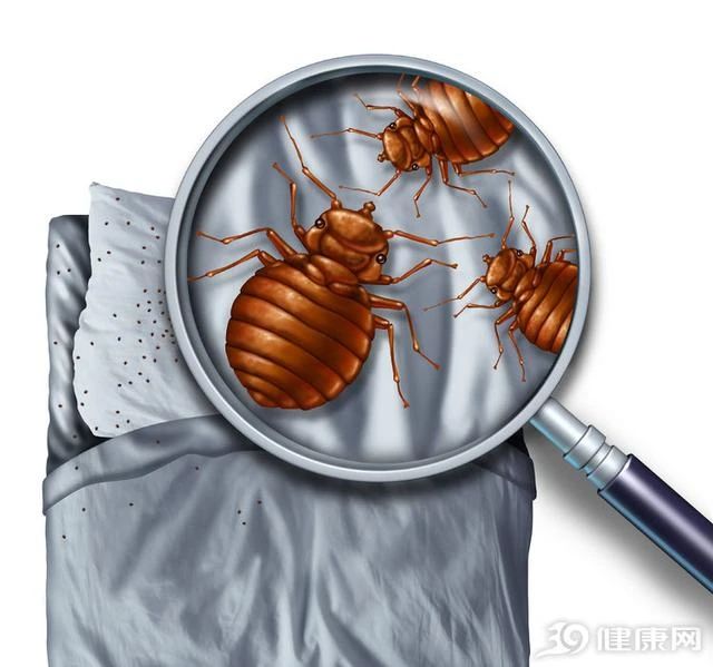 臭虫消杀多少钱_臭虫消杀_臭虫消杀疾控中心管吗