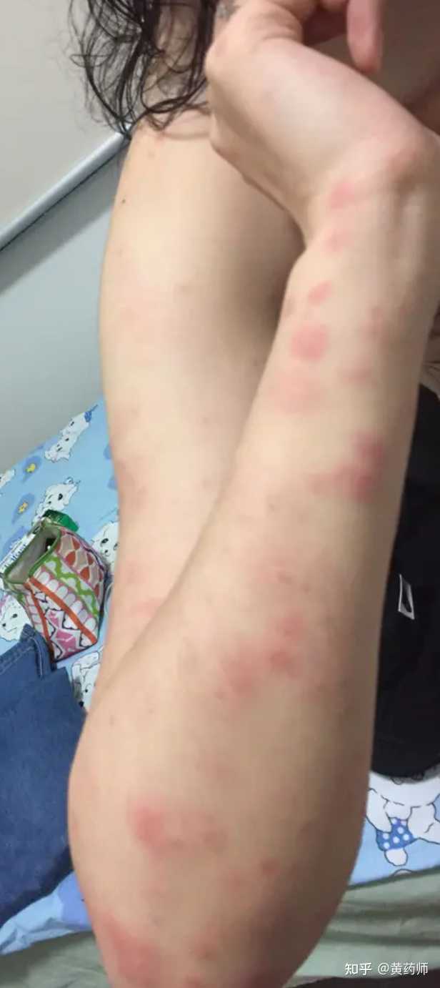 蟑螂药灭蟑螂_灭蟑螂药品_灭蟑螂药哪种最有效