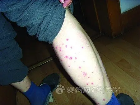 跳蚤的卵_跳蚤的卵_跳蚤的卵