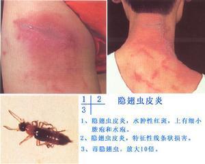 灭白蚁用什么杀虫剂_灭白蚁的最好办法_灭白蚁有毒吗