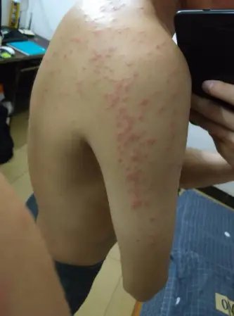 杀臭虫的药粉_灭臭虫用什么药最好_杀臭虫药排行榜