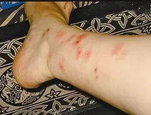 杀臭虫的药粉_杀臭虫药排行榜_灭臭虫用什么药最好