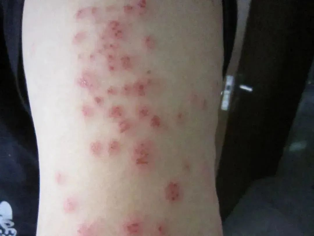 四川臭虫_成都灭臭虫_成都臭虫多吗