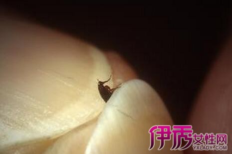 消灭跳蚤有什么办法_如何灭跳蚤一次全消灭_有效消灭跳蚤