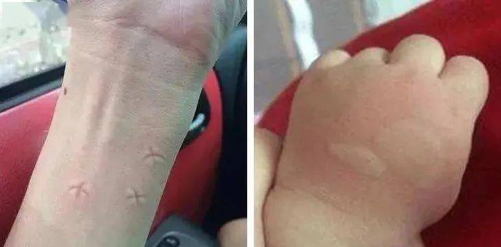 长效杀蚊子用什么药_灭蚊子特效药长效药_长效灭蚊药有哪些